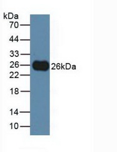 Polyclonal Antibody to T-Cell Immunoreceptor With Ig And ITIM Domains Protein (TIGIT)