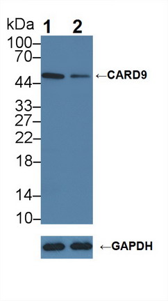 Polyclonal Antibody to Caspase Recruitment Domain Family, Member 9 (CARD9)