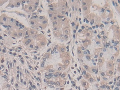 Polyclonal Antibody to Suppression Of Tumorigenicity 14 (ST14)