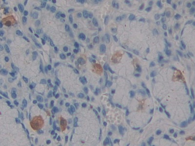 Polyclonal Antibody to Pim-2 Oncogene (PIM2)
