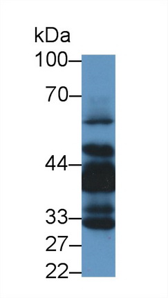Polyclonal Antibody to LIM And Senescent Cell Antigen Like Domains Protein 1 (LIMS1)