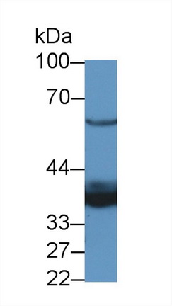 Polyclonal Antibody to LIM And Senescent Cell Antigen Like Domains Protein 1 (LIMS1)
