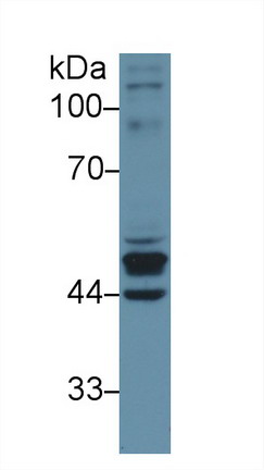 Polyclonal Antibody to Keratin 23 (KRT23)