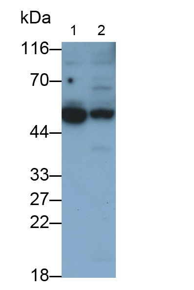 Polyclonal Antibody to Keratin 23 (KRT23)