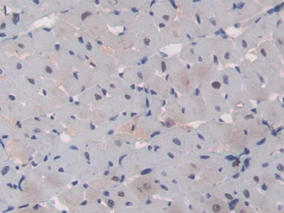 Polyclonal Antibody to Cluster Of Differentiation 8b (CD8b)