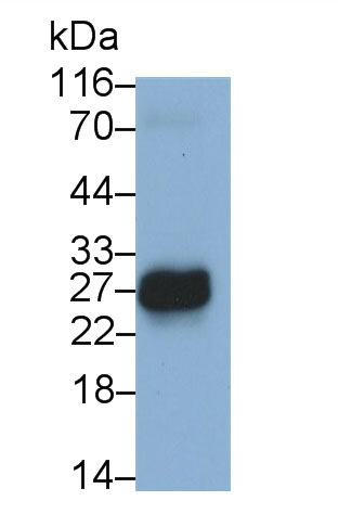 Polyclonal Antibody to Coiled Coil Domain Containing Protein 3 (CCDC3)