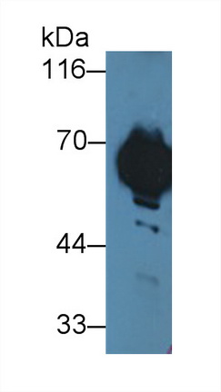 Polyclonal Antibody to NADH Dehydrogenase 5 (ND5)