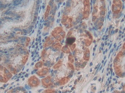Polyclonal Antibody to Family With Sequence Similarity 132, Member A (FAM132A)