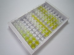 ELISA Kit for Carcinoembryonic Antigen (CEA)