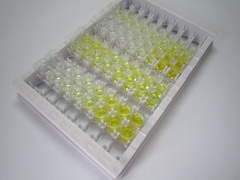ELISA Kit for Complement Factor D (CFD)