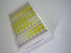 ELISA Kit for Actinin Alpha 4 (ACTN4)
