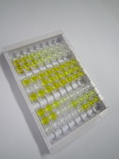 ELISA Kit for Leukocyte Cell Derived Chemotaxin 2 (LECT2)