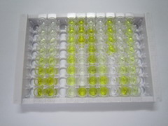 ELISA Kit for Methionyl Aminopeptidase 2 (METAP2)