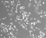Splenic Macrophages (SM)