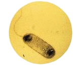 Legionella Pneumophila (LP)