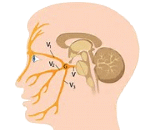 Trigeminal Neuralgia (TN)