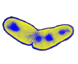 Mycobacterium Tuberculosis (MTB)