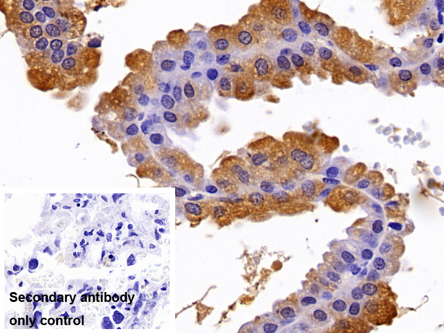 Polyclonal Antibody to Parathyroid Hormone Related Protein (PTHrP)