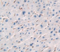 Polyclonal Antibody to Regulator Of G Protein Signaling 4 (RGS4)