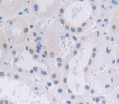 Polyclonal Antibody to Nucleoporin 188kDa (NUP188)