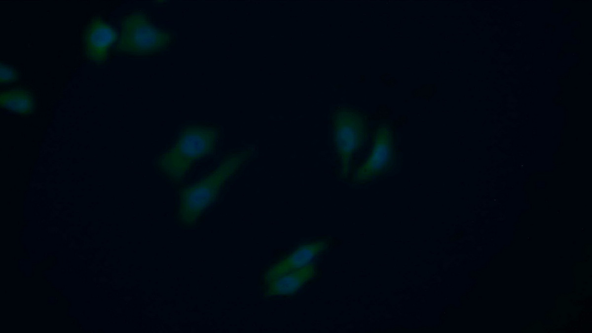 Polyclonal Antibody to ATP Dependent DNA ligase I (LIG1)