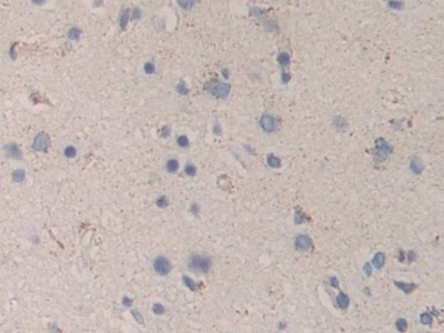 Polyclonal Antibody to MAP Kinase Activated Protein Kinase 2 (MAPKAPK2)