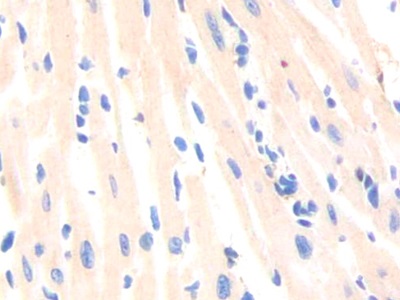 Polyclonal Antibody to Poliovirus Receptor Related Protein 3 (PVRL3)