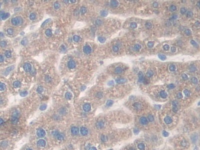 Polyclonal Antibody to Density Enhanced Phosphatase 1 (DEP1)