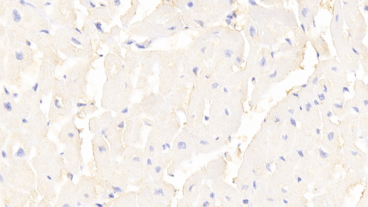 Polyclonal Antibody to Integrin Linked Kinase (ILK)