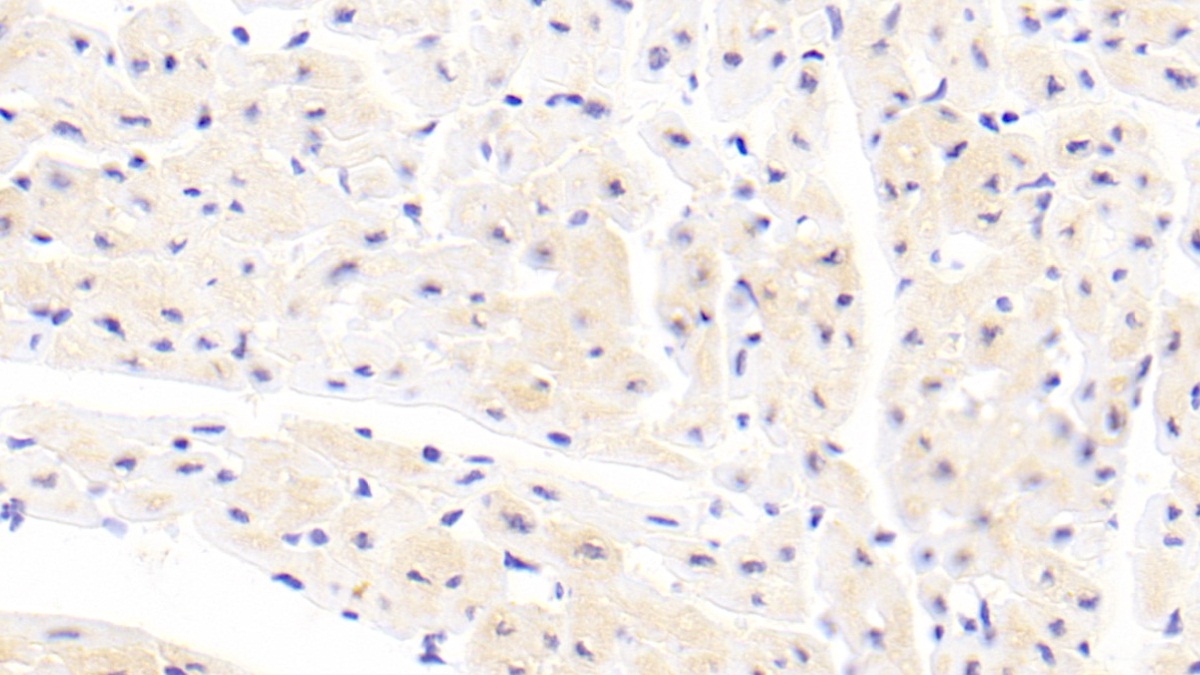 Polyclonal Antibody to Cofilin 2, Muscle (CFL2)