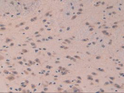 Polyclonal Antibody to Eukaryotic Translation Initiation Factor 3A (EIF3A)