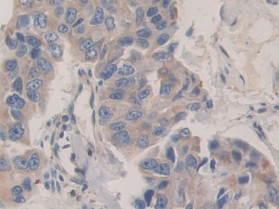 Polyclonal Antibody to Cadherin 16 (CDH16)