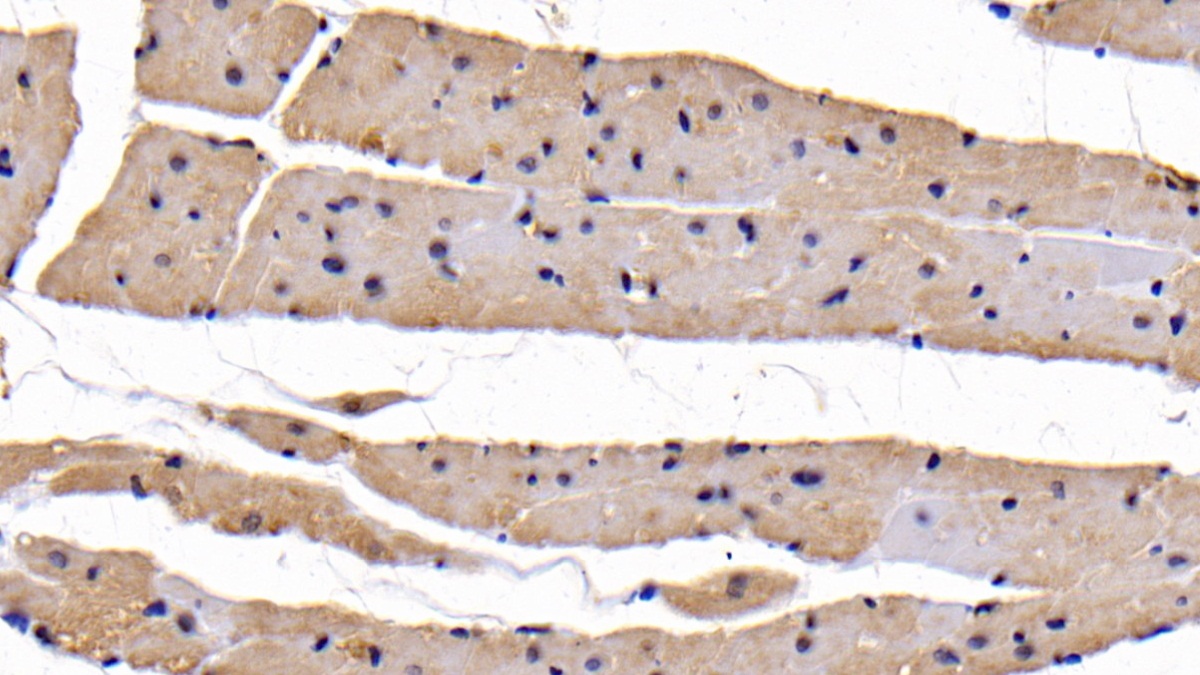 Polyclonal Antibody to Activin A Receptor Type II B (ACVR2B)