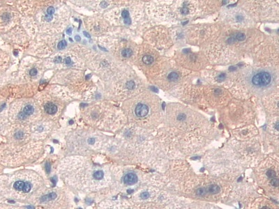 Polyclonal Antibody to V-Erb B2 Erythroblastic Leukemia Viral Oncogene Homolog 3 (ErbB3)