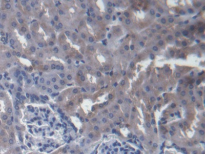 Polyclonal Antibody to Host Cell Factor C1 (HCFC1)