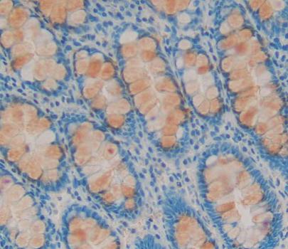 Polyclonal Antibody to Mediator Complex Subunit 1 (MED1)