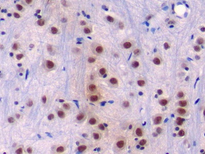 Polyclonal Antibody to Disrupted In Schizophrenia 1 (DISC1)