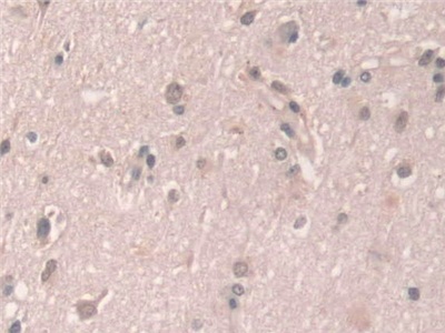Polyclonal Antibody to Grancalcin (GCA)
