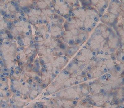 Polyclonal Antibody to Gastrin Releasing Peptide Receptor (GRPR)