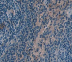 Polyclonal Antibody to Hemopoietic Cell Kinase (HCK)