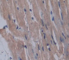 Polyclonal Antibody to Intestinal Cell Kinase (ICK)
