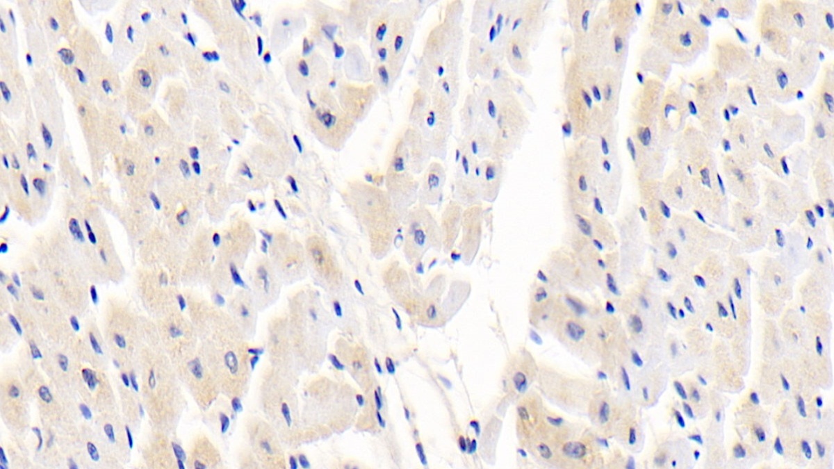 Polyclonal Antibody to Dystrophia Myotonica Protein Kinase (DMPK)