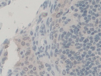 Polyclonal Antibody to Peroxisomal Biogenesis Factor 1 (PEX1)