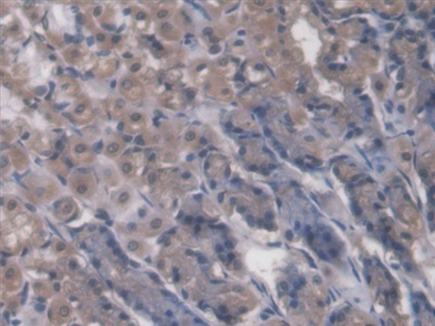 Polyclonal Antibody to Rhotekin (RTKN)