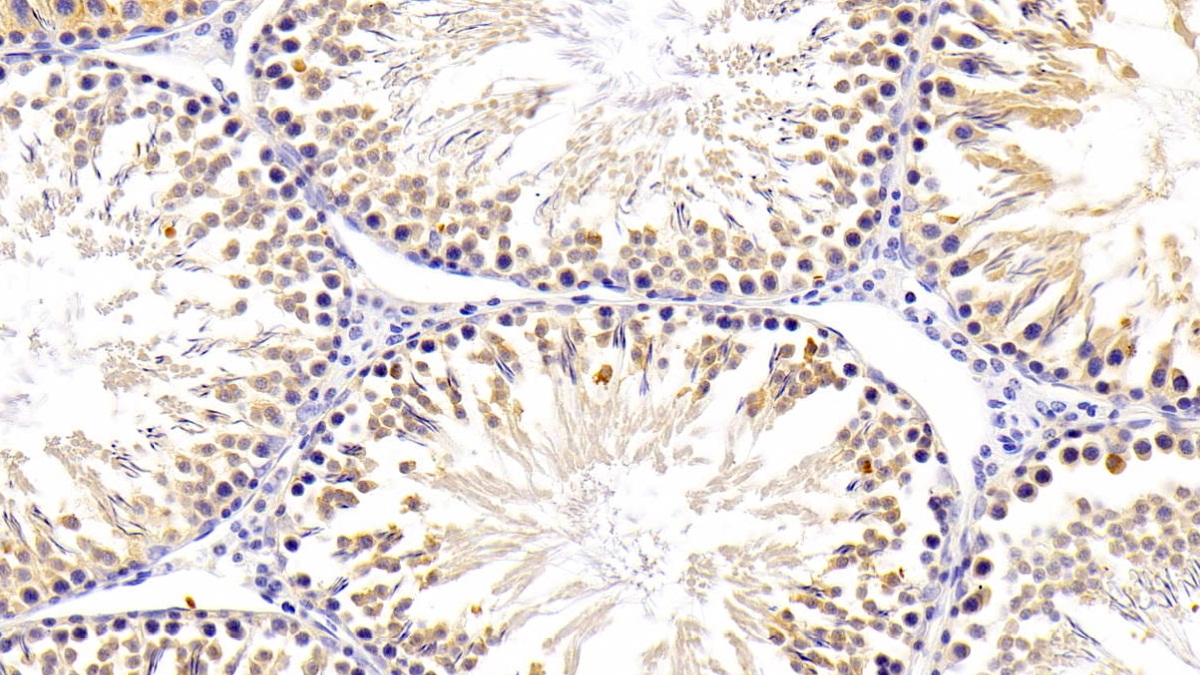 Polyclonal Antibody to Signal Transducing Adaptor Molecule 2 (STAM2)