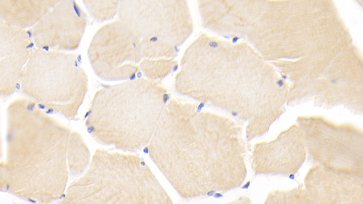 Polyclonal Antibody to Myosin Light Chain 6B, Alkali, Smooth Muscle And Non Muscle (MYL6B)