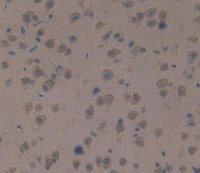 Polyclonal Antibody to Protein Tyrosine Phosphatase Receptor Type Z (PTPRZ)