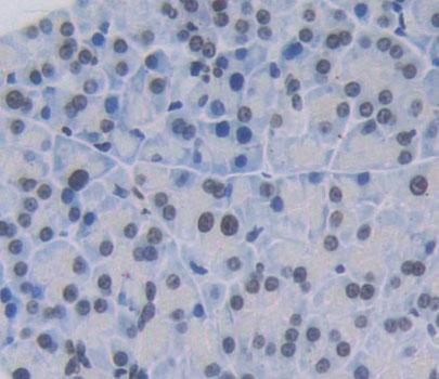 Polyclonal Antibody to Insulinoma Associated Protein 1 (INSM1)