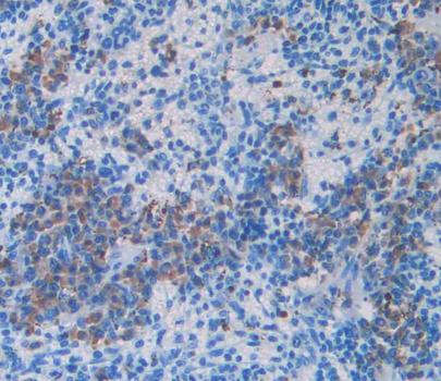 Polyclonal Antibody to Tumor Necrosis Factor Receptor Superfamily, Member 19 Like Protein (TNFRSF19L)