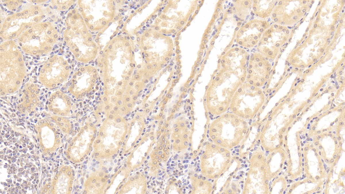 Polyclonal Antibody to Tumor Necrosis Factor Receptor Superfamily, Member 19 (TNFRSF19)